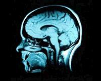Nanotech and genetic interference may tackle untreatable brain tumors