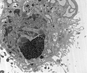 Tests Show Bright Future For Gadonanotubes In Stem Cell Tracking
