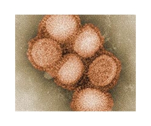 France cancels half flu vaccine orders