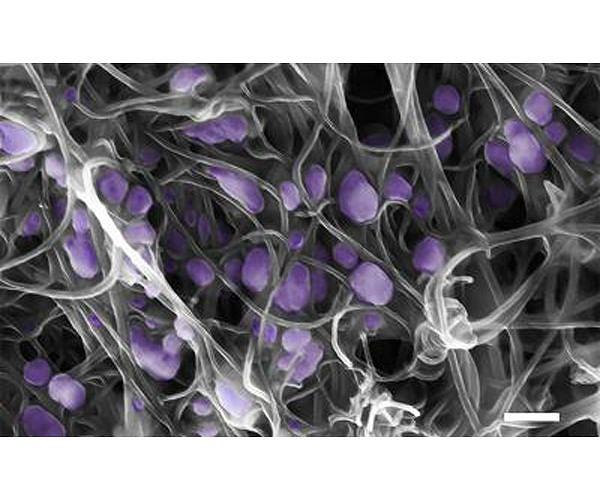 Influenza or a cold? A new technology can help you