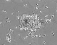 New Source of Multipotent Adult Stem Cells in Human Hair Follicles