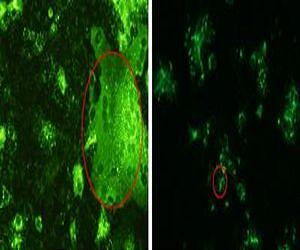 New bat virus could hold key to Hendra virus