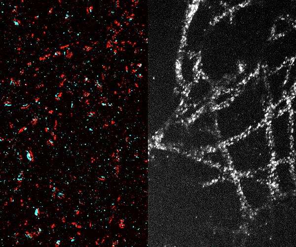 A new method makes high-resolution imaging more accessible