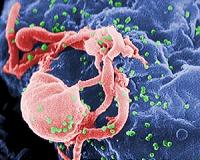 Mideast sees 'worrying' rise in HIV cases: UN