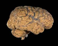 Will Our Future Brains Be Smaller