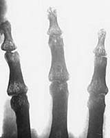 Researcher To Study Astronaut Bone Loss For Space Biology Agency