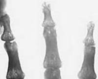 Cartilage Regeneration 20000 Leagues Under The Sea