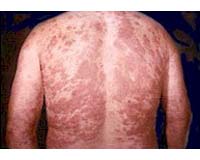 Finding Cures For The Disease Of Neglect