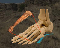 Long-overlooked arch is key to fuction, evolution of human foot
