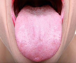 Tongue Analysis Software Developed at MU Uses Ancient Chinese Medicine to Warn of Disease