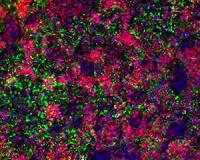 Neurons controlling appetite made from skin cells