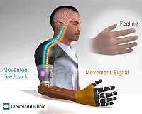 Researchers uncover way to restore movement sensation in upper limb amputation patients