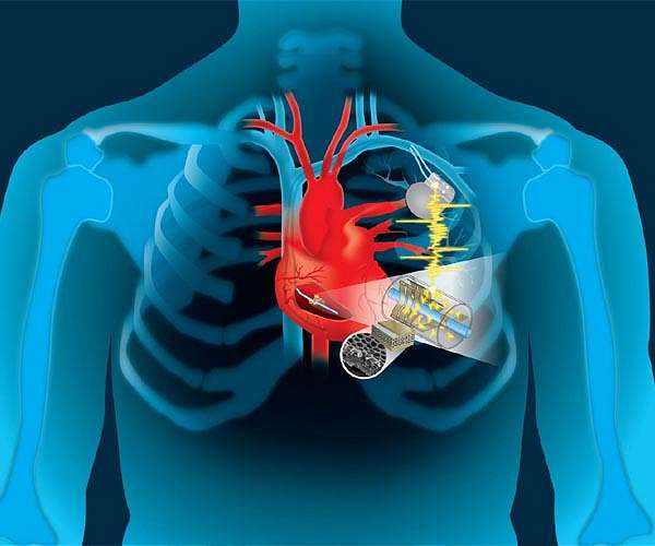 Study: Cellphones, smartwatches may interfere with medical implants