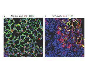 Stem cells repair lung damage after flu infection