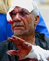 Disputed Iraqi Bodycount