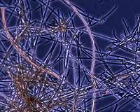 Warmer temperatures to boost CO2 emissions from bacteria