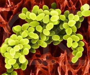 Do Bacteria Age? Biologists Discover the Answer Follows Simple Economics