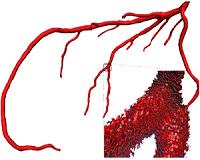 3D bioprinting technique could create artificial blood vessels, organ tissue