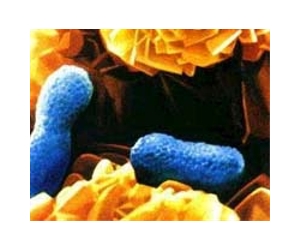 Designer Probiotics Could Reduce Obesity
