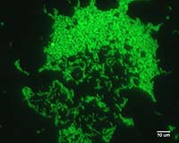 World-First Technology Enables Study Of Ancient Bacteria