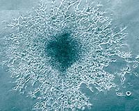 For First Time, Brain Cells Generated In A Dish