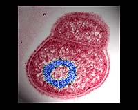 Radiation-Resistant Organism Reveals Its Defense Strategies