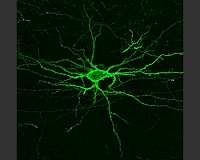 Seeing the brain's electrical activity