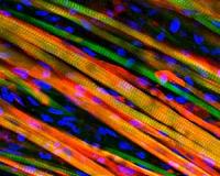 Intertwined evolution of human brain and brawn