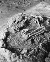 Magdalenian Girl Has Oldest Recorded Case Of Impacted Wisdom Teeth