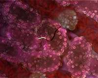 Scientists close in on malaria vaccine