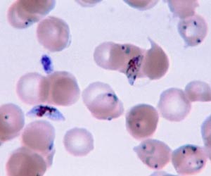 African antimalarial research bears first fruit