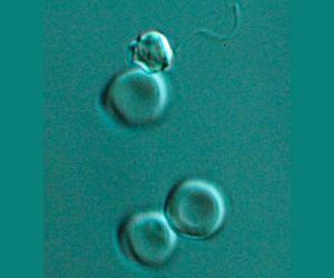 Holograms offer hope in fight against malaria