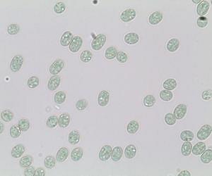 Model helps pinpoint cyanobacterial genes that capture the sun's energy