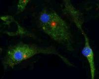 Scientists find molecule that may treatment inflammatory diseases