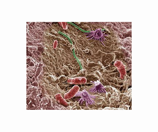 A few common bacteria dominate soil's carbon cycle