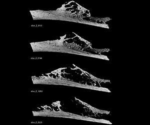 Penn Research Indentifies Bone Tumor in 120,000-Year-Old Neandertal Rib