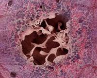 Bone marrow-on-a-chip unveiled