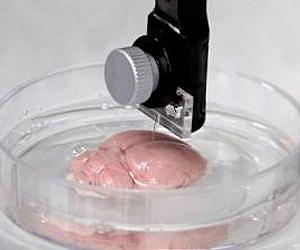 Building better brain implants: The challenge of longevity