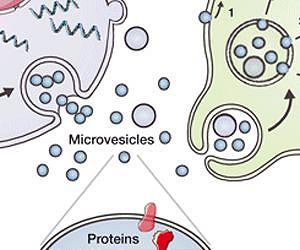 Detection, analysis of 'cell dust' may allow diagnosis, monitoring of brain cancer