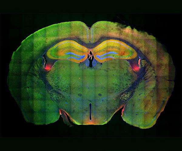 Liquid shock absorbers in football helmets could reduce impact on brains