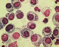 New anti-cancer control mechanism found