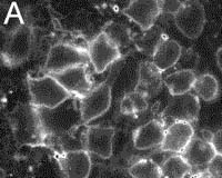 After Quantum Dots, Now Come Glowing 'Cornell Dots'