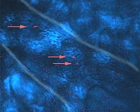 Purdue's Gold Nanorods Brighten Future For Medical Imaging