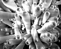 Tiny Nanowire Could Be Next Big Diagnostic Tool For Doctors