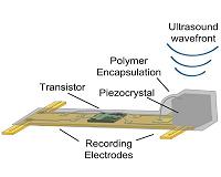 Implantable Neural Dust Enables Precise Wireless Recording of Nerve Activity