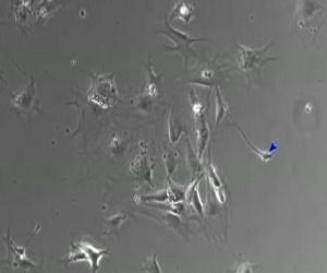 New human neurons from adult cells right there in the brain