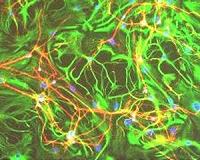 Scientists build world's tiniest hammer to bang on brain cells