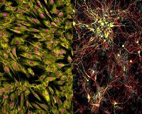 Aged neurons can now be generated using stem cell technology