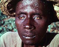 Controlling Neglected Tropical Diseases May Be Key To US Foreign Policy