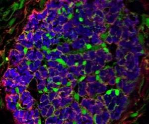 Origin Of Cells Associated With Nerve Repair Discovered